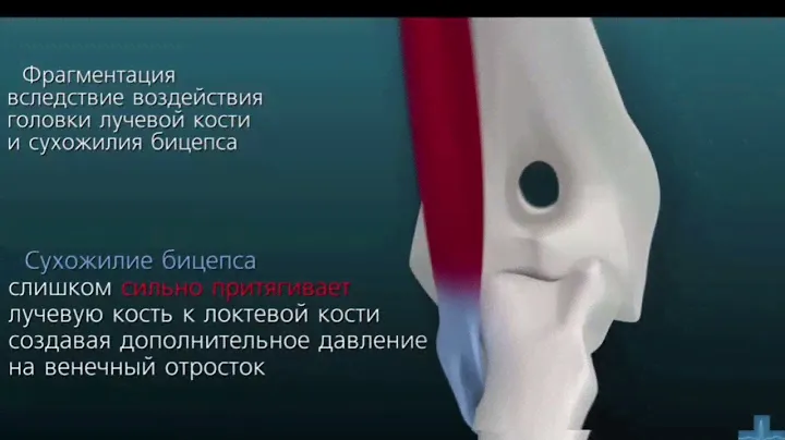 При малейшей хромоте обращайтесь к специалисту | Ветеринарная клиника "Добрый Доктор Воронеж"